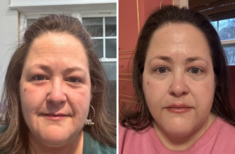 A Personal Update (My Year of No Sugar, Weight Loss, Castor Oil, Etc.)